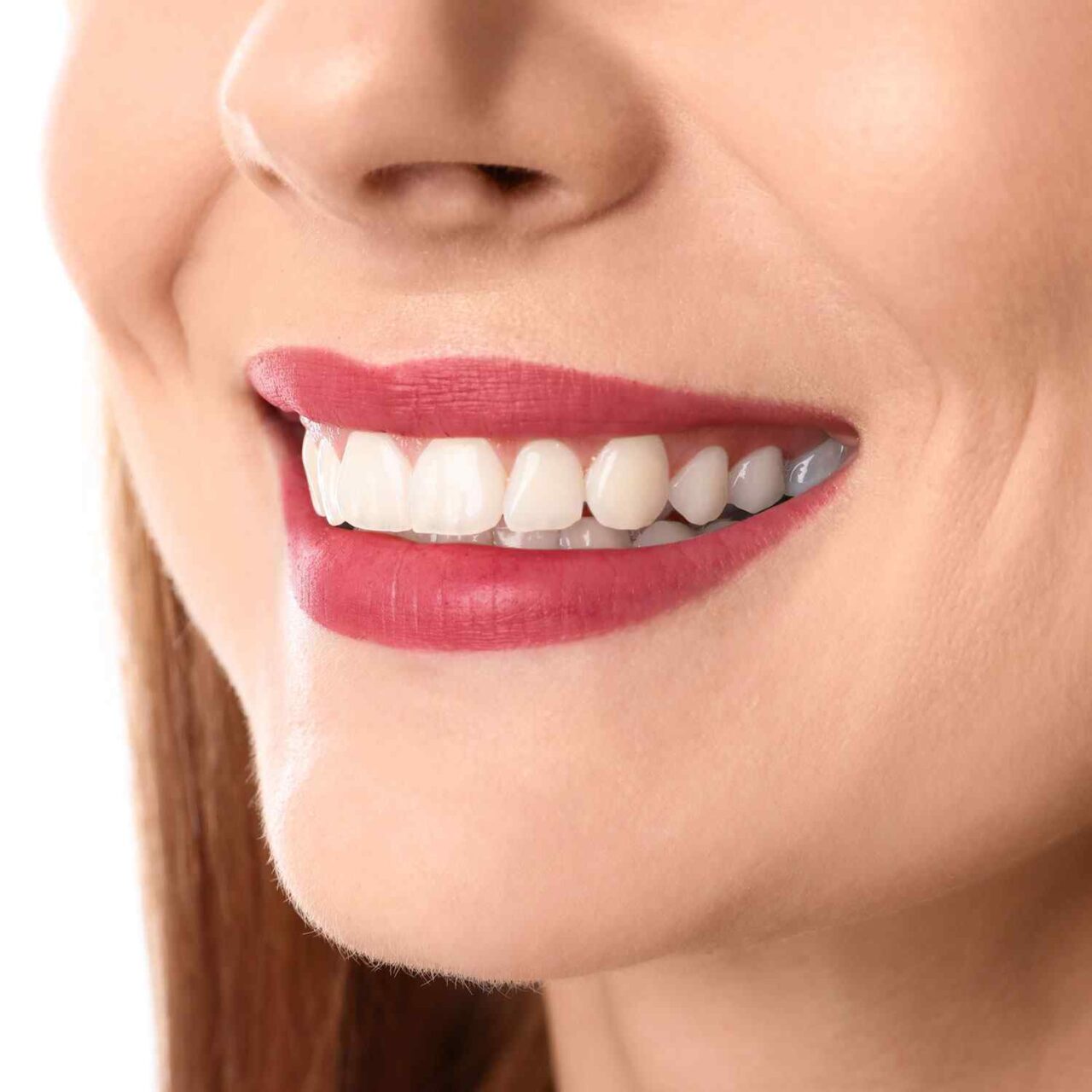 https://www.veneerdent.com/wp-content/uploads/2020/03/service_whitening-1280x1280.jpg